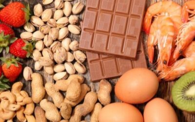 “Principales Alimentos que causan Alergias”, nuevo tema del curso de ‘Manipulador de Alimentos’